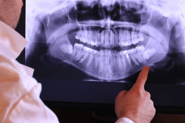 Best Tooth Pain Emergency Relief  in Walce, LA